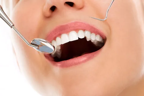 Veja mais sobre Sonhar com dente: o que significa?