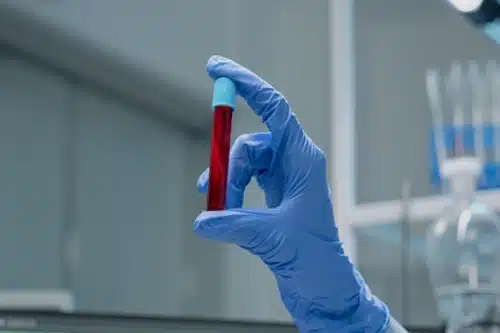 Veja mais sobre Sonhar com sangue o que significa